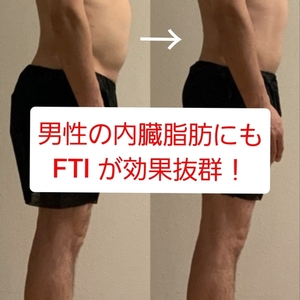 男性のぽっこりお腹にはFTIマシーン！